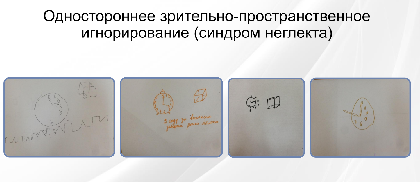 Синдром неглекта примеры